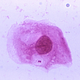 UK scientists want to know whether it’s worth vaccinating teens against a certain type of bacteria that causes meningitis called Neisseria meningitidis, seen above.